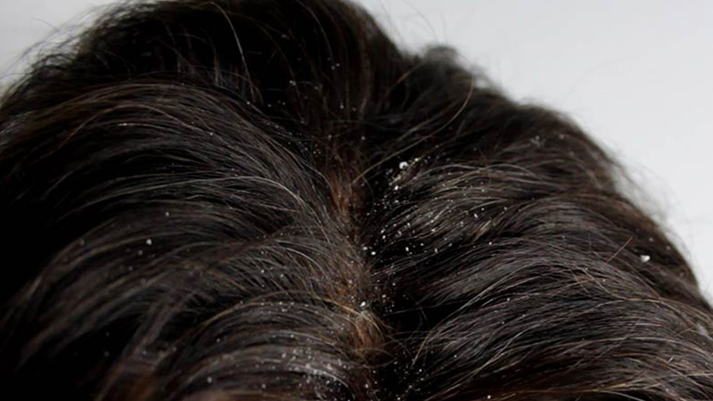 5 công dụng hữu ích từ lá dứa không nên bỏ qua 4