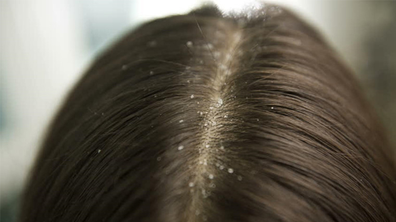 công dụng làm đẹp của aspirin