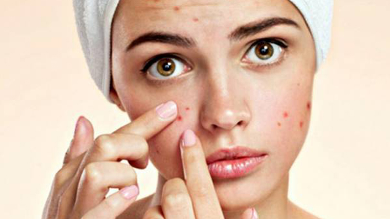 Bị nóng trong người