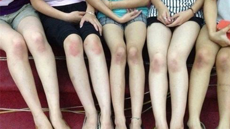 cách làm trắng khuỷu tay và đầu gối